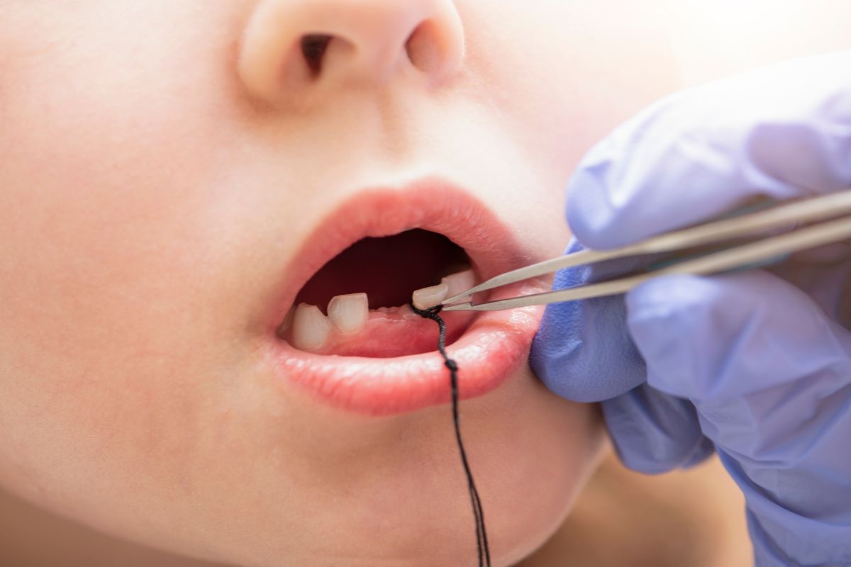 is it safe for a 3-year-old kid to have a tooth extracted