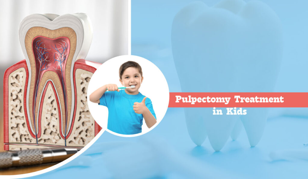 Pulpotomy vs Pulpectomy