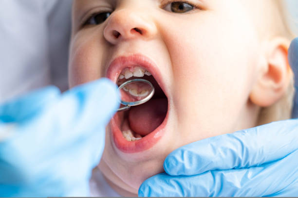 Dentist checking a baby's tongue movement for signs of tongue-tie